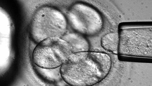 Das Bild zeigt, wie einem menschlichen Embryo Stammzellen entnommen werden. Der Embryo stirbt, die Zellen sollen der Forschung dienen. Das Bild zeigt, wie einem menschlichen Embryo Stammzellen entnommen werden. Der Embryo stirbt, die Zellen sollen der Forschung dienen.