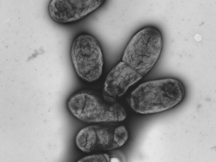 Eine elektronenmikroskopische Aufnahme zeigt das Pestbakterium Yersinia pestis. In China wurde der vierte Fall einer Pestinfektion innerhalb weniger Wochen gemeldet.