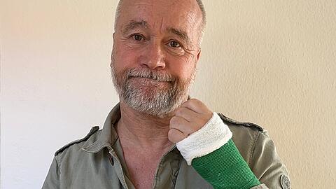 Fahrradunfall mit Folgen: Schauspieler Thomas Darchinger wurde bei einem Crash mit einem Auto verletzt.
