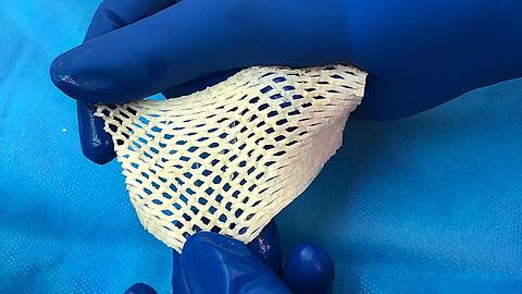 Wichtige Alternative f&uuml;r Hautttansplantationen: Fischhaut.