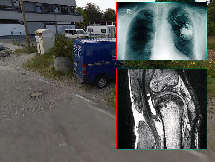 Am Marieluise-Fleißer-Bogen in Neuperlach hat ein Passant Säcke voller Röntgenbilder gefunden. (Rechts: Symbolbilder)