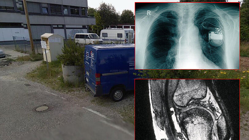 Am Marieluise-Fleißer-Bogen in Neuperlach hat ein Passant Säcke voller Röntgenbilder gefunden. (Rechts: Symbolbilder) Am Marieluise-Fleißer-Bogen in Neuperlach hat ein Passant Säcke voller Röntgenbilder gefunden. (Rechts: Symbolbilder)