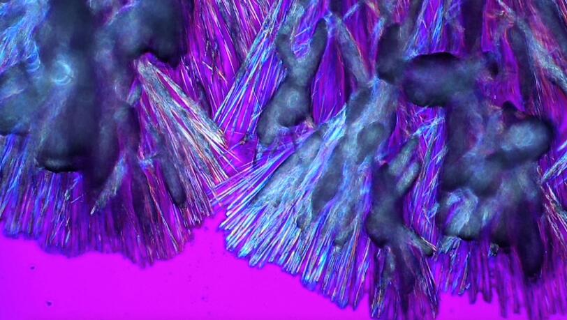 Verschiedene Kristallisationsformen des Harnstoffs Urea.