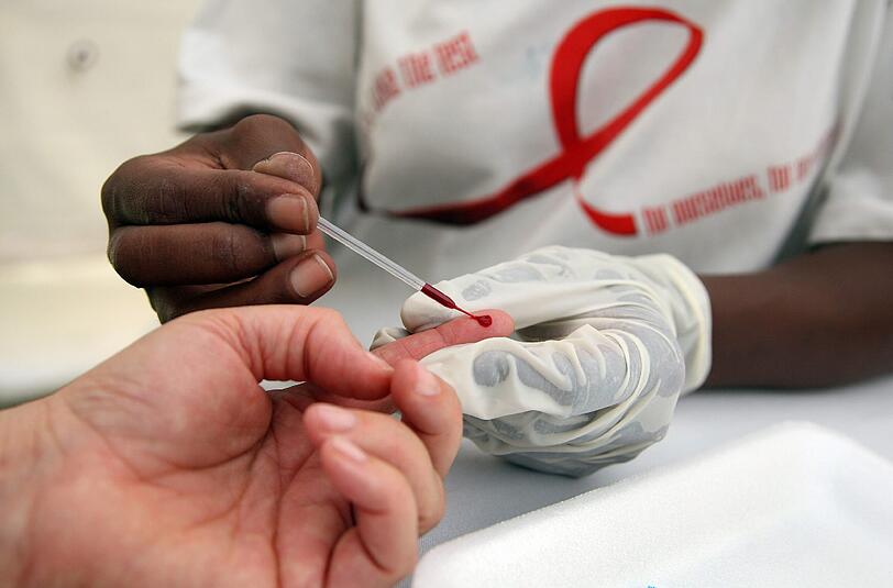 Ein Mann wird im südafrikanischen Johannesburg auf HIV getestet. Gegenwärtig infizieren sich jährlich weltweit noch rund 2,1 Millionen Menschen mit dem HI-Virus. Foto: Jon Hrusa/Archiv