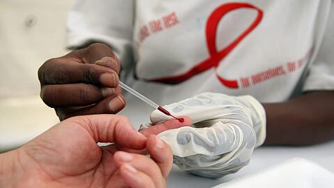 Ein Mann wird im südafrikanischen Johannesburg auf HIV getestet. Gegenwärtig infizieren sich jährlich weltweit noch rund 2,1 Millionen Menschen mit dem HI-Virus. Foto: Jon Hrusa/Archiv