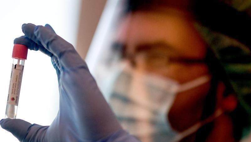 Seit Samstag können sich Reiserückkehrer kostenlos auf das Coronavirus testen lassen. Seit Samstag können sich Reiserückkehrer kostenlos auf das Coronavirus testen lassen.