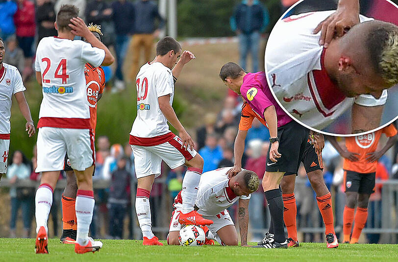 Nur was für Hartgesottene: Menez mit stark lädiertem Ohr direkt nach dem fatalen Zweikampf.