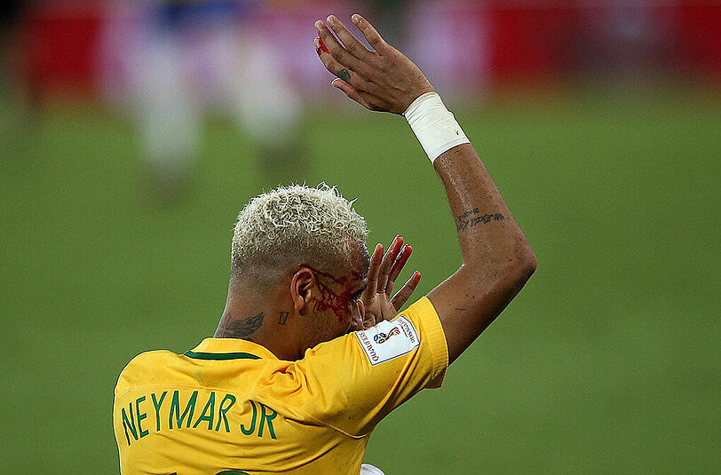 Die Neymar-Show beim 5:0 (4:0) im WM-Qualifikationsspiel gegen Bolivien fand nach einem Ellbogen-Stoß ihr spektakuläres, blutiges Schlussbild.
