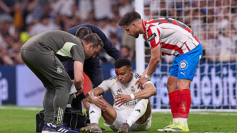 Blutende Wunde: Real-Star Kylian Mbapp&eacute; (M.).