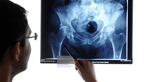 Aufgrund einer riesigen Datenpanne kursierten Patientendaten &ndash; darunter auch Röntgenbilder, wie hier zu sehen &ndash; offen im Netz.