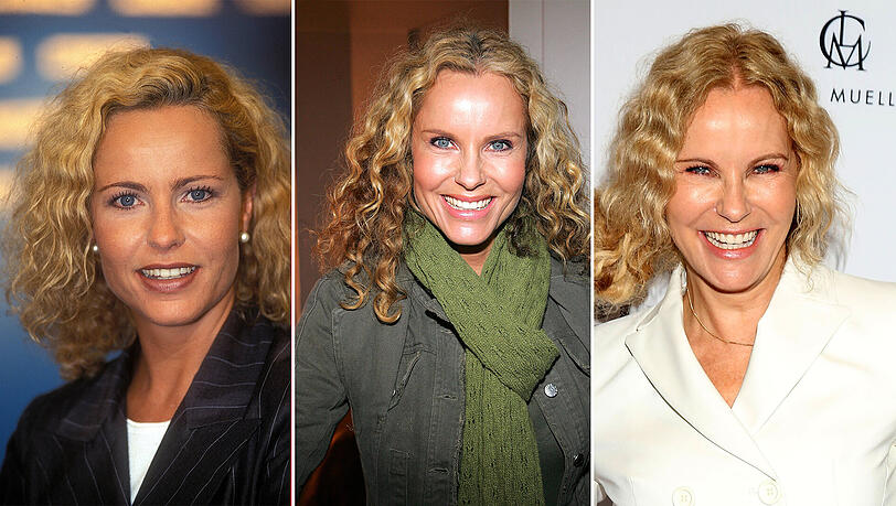 Botox für Katja Burkard: RTL-Moderatorin spricht über Schönheitseingriffe  im Gesicht | Abendzeitung München