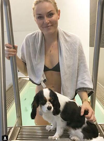 Auch Lindsey Vonn musste in den vergangenen Jahren einiges an Verletzungen einstecken.