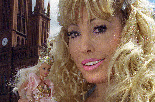 ... die Blondine hat so ziemlich alles machen lassen, was geht. Von über 20 Operationen spricht die lebendige Barbie.