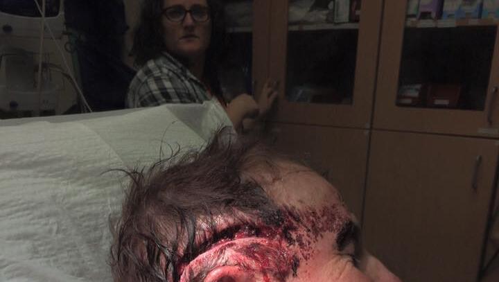 Im Krankenhaus wurde die Wunden des Amerikaners versorgt. Natürlich musste auch dieser Schritt mit einem Foto festgehalten werden. Im Krankenhaus wurde die Wunden des Amerikaners versorgt. Natürlich musste auch dieser Schritt mit einem Foto festgehalten werden.