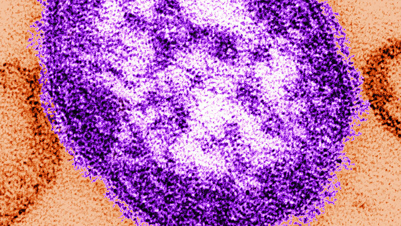 Das Bild wurde mithilfe eines Transmissionselektronenmikroskops gemacht und zeigt Teile eines Masernvirus.