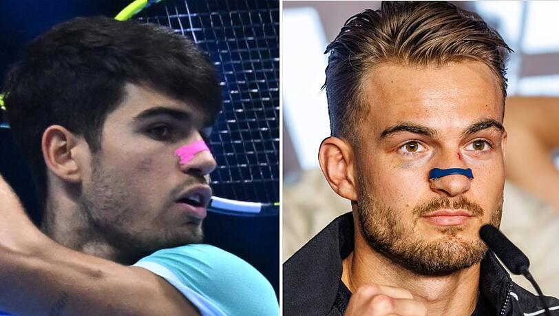 Ob Carlos Alcaraz in Turin oder Can Kaplan beim Fame Fighting - immer mehr Menschen tragen Nasenpflaster.