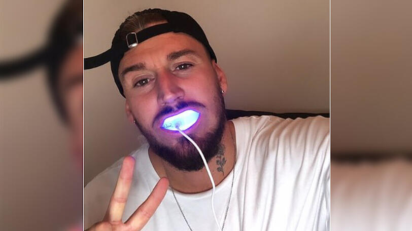 Mike Heiter bleacht seine Keramik-Zähne mit einem LED-Mundstück, das ans Handy angeschlossen wird.