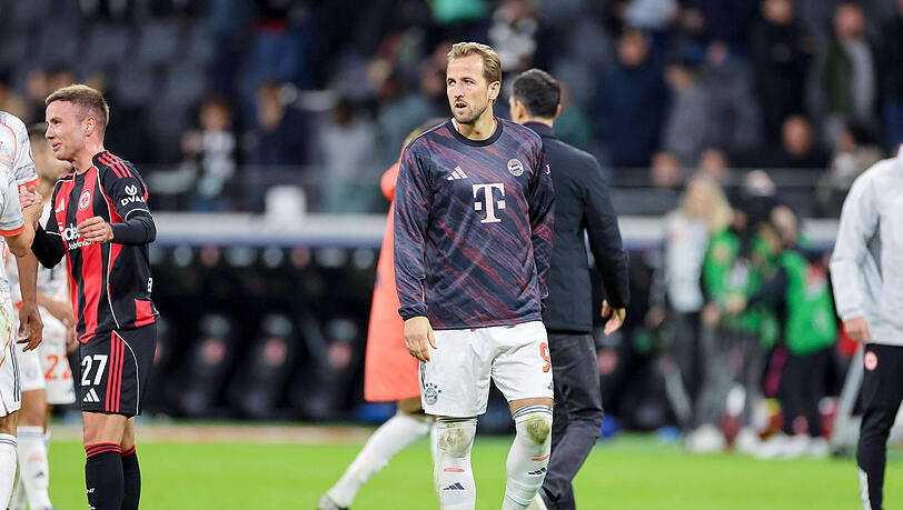 Harry Kane läuft mit einem Eisbeutel am rechten Fuß über den Platz, gibt aber Entwarnung.