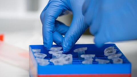 Der Coronavirus hat nun auch Auswirkungen auf den Sport.
