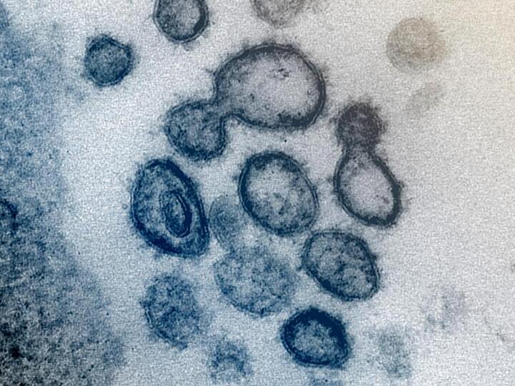Das neuartige Coronavirus SARS-CoV-2 unter dem Elektronenmikroskop. Foto: Uncredited/NIAID-RML/AP/dpa/Archivbild