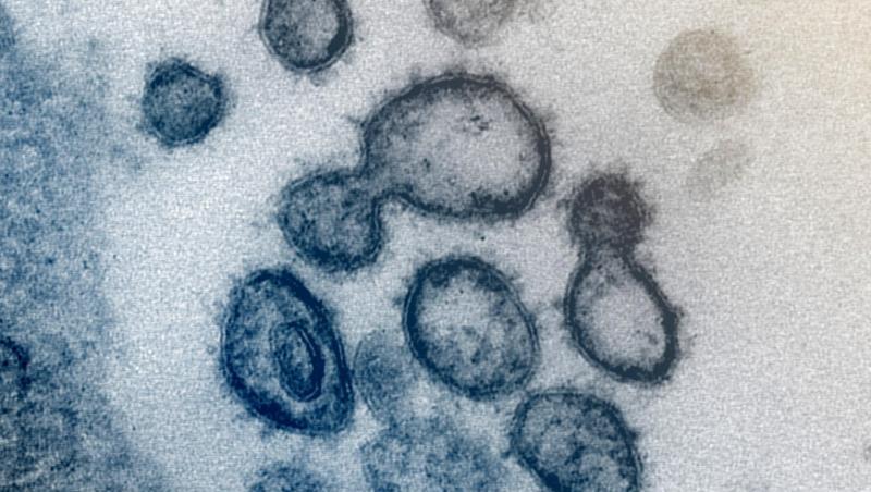 Das neuartige Coronavirus SARS-CoV-2 unter dem Elektronenmikroskop. Foto: Uncredited/NIAID-RML/AP/dpa/Archivbild Das neuartige Coronavirus SARS-CoV-2 unter dem Elektronenmikroskop. Foto: Uncredited/NIAID-RML/AP/dpa/Archivbild