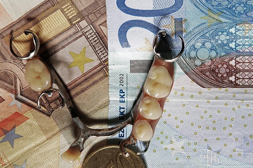 Ein Obergebiss mit Gold im Wert von etwa 200 Euro wurde für einen Betrüger in Neuhausen zum Diebesgut.