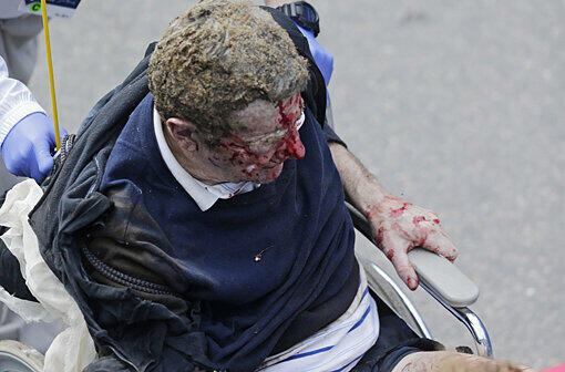 Explosion im Zielgelände des Boston Marathons: Die weiteren Bilder vom dramatischen Ereignis.