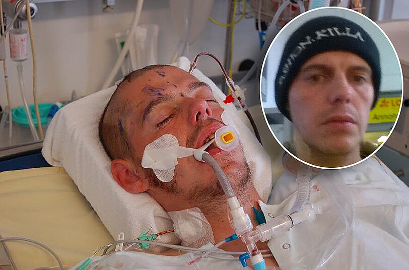 Der 37-Jährige liegt nach dem Angriff im Wachkoma.