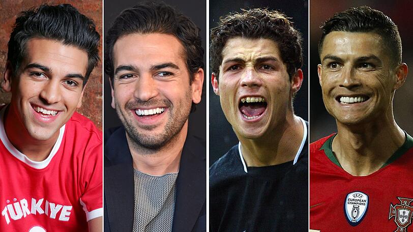Zahnspange, Keramik-Veneers oder Bleaching - bei diesen VIPs wurde was gemacht...