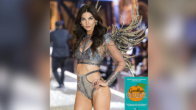 Selbst "Victoria's Secret"-Model Lily Aldridge hat nach eigener Aussage Cellulite