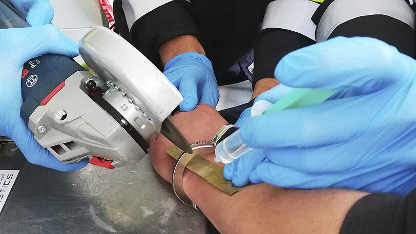 Vorsichtig und unter dauerhafter Kühlung wurde die Handschelle in wenigen Minuten vom Arm des Mannes "geflext".