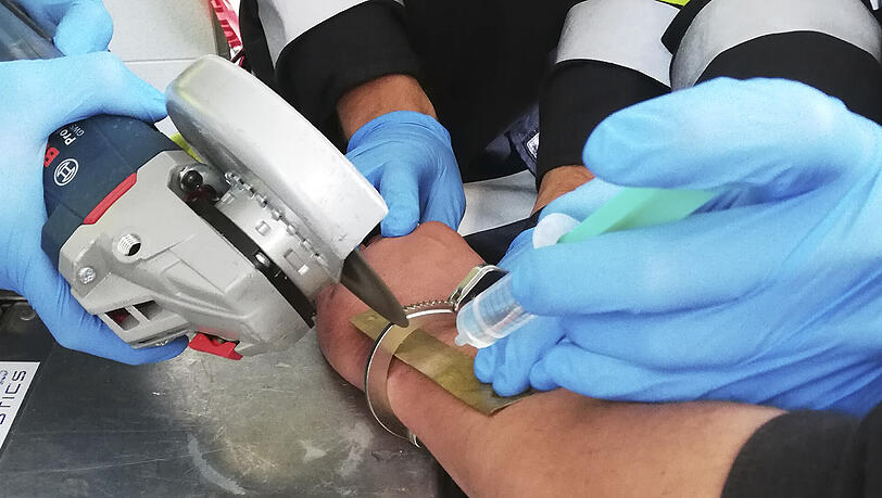 Vorsichtig und unter dauerhafter Kühlung wurde die Handschelle in wenigen Minuten vom Arm des Mannes "geflext". Vorsichtig und unter dauerhafter Kühlung wurde die Handschelle in wenigen Minuten vom Arm des Mannes "geflext".