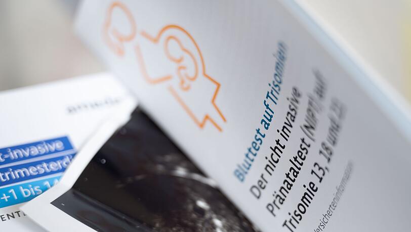 Jede zweite Schwangere in Bayern testet inzwischen auf Trisomien. (Symbolbild)