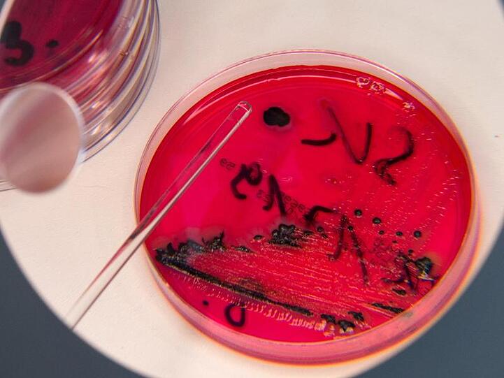 In einem Labor werden Salmonellen in einer Petrischale gezeigt. Foto: Arno Burgi/zb/dpa/Archivbild