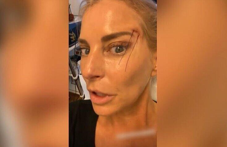 Lidstraffung für Giulia Siegel: Die DJane präsentiert auf Instagram eine Behandlung beim Beauty-Doc.