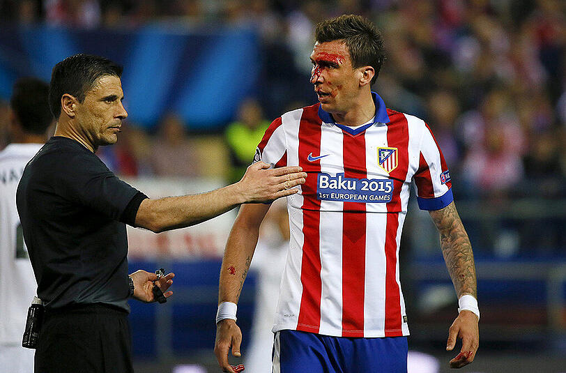 Schwer gezeichnet: Mario Mandzukic erlitt im Hinspiel eine Platzwunde.