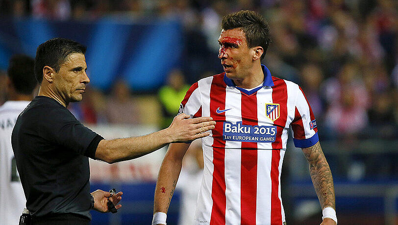 Schwer gezeichnet: Mario Mandzukic erlitt im Hinspiel eine Platzwunde. Schwer gezeichnet: Mario Mandzukic erlitt im Hinspiel eine Platzwunde.