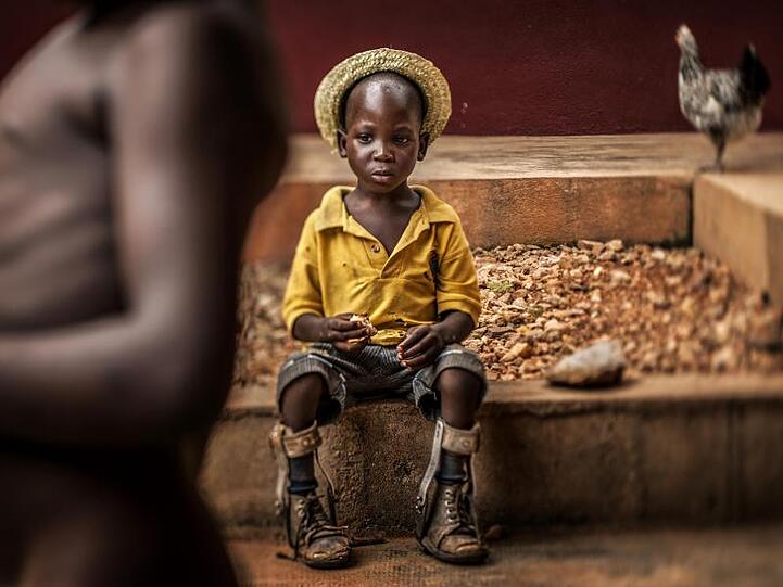Das "Unicef-Foto des Jahres 2018" zeigt einen Jungen mit Beinprothesen in einem Waisenhaus in Bombouaka, Togo.