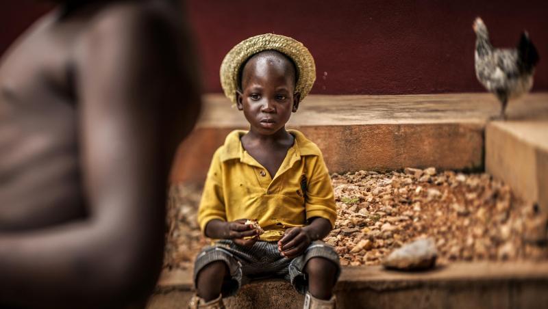 Das "Unicef-Foto des Jahres 2018" zeigt einen Jungen mit Beinprothesen in einem Waisenhaus in Bombouaka, Togo. Das "Unicef-Foto des Jahres 2018" zeigt einen Jungen mit Beinprothesen in einem Waisenhaus in Bombouaka, Togo.
