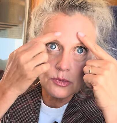 Barbara Schöneberger zeigt in einem Video die Stelle, an der sie sich Botox unterspritzen ließ. Barbara Schöneberger zeigt in einem Video die Stelle, an der sie sich Botox unterspritzen ließ.