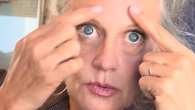 Barbara Sch&ouml;neberger zeigt in einem Video die Stelle, an der sie sich Botox unterspritzen lie&szlig;.