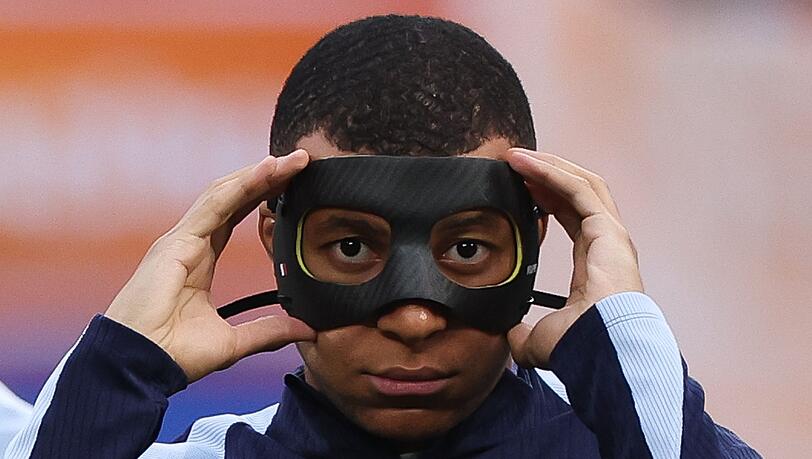 Hatte sich in der Partie gegen Österreich einen Nasenbeinbruch zugezogen: Frankreichs Kylian Mbappe.