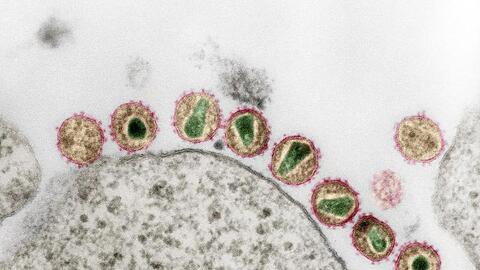 HIV-1 (Retroviren) in einer kolorierten Ultradünnschnitt-Aufnahme eines Transmissions-Elektronenmikroskops.