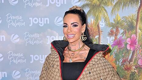 Gina-Lisa Lohfink spricht &uuml;ber die Folgen einer verheerenden Sch&ouml;nheitsoperation.