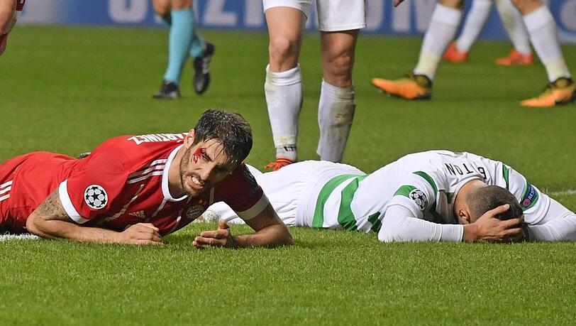 Blutige Erinnerung: Beim letzten Duell 2017 holte sich Bayern-Star Javi Martínez (l.) gegen Celtic einen Cut über dem Auge. Blutige Erinnerung: Beim letzten Duell 2017 holte sich Bayern-Star Javi Martínez (l.) gegen Celtic einen Cut über dem Auge.