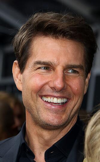 Heute strahlt Hollywood-Star Tom Cruise und zeigt seine neuen Zähne
