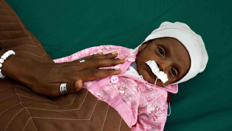 Ein 38 Tage altes unterernährtes Baby in einem Krankenhaus im Jemen. 60 Prozent der Bevölkerung in dem Land können sich keine Grundnahrungsmittel mehr leisten.