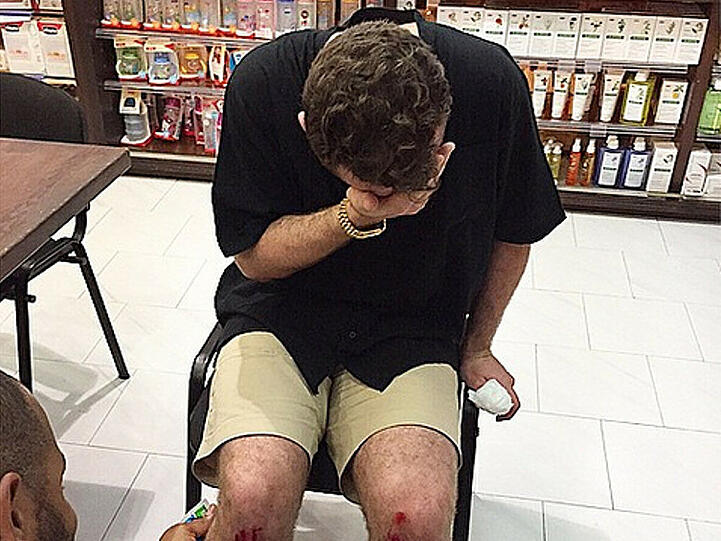 Sam Smiths Wunde muss behandelt werden