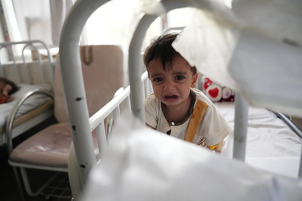 Ein Kind, das wegen Unterernährung im Indira-Gandhi-Institut für Kindergesundheit in Kabul behandelt wird. Ein Kind, das wegen Unterernährung im Indira-Gandhi-Institut für Kindergesundheit in Kabul behandelt wird.