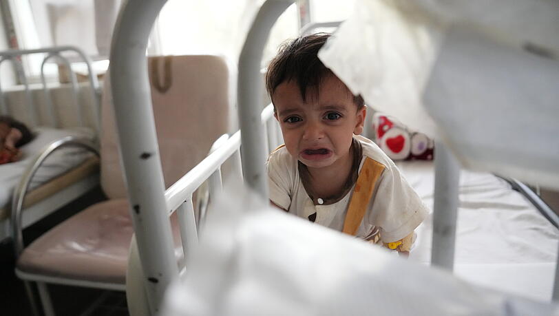 Ein Kind, das wegen Unterernährung im Indira-Gandhi-Institut für Kindergesundheit in Kabul behandelt wird. Ein Kind, das wegen Unterernährung im Indira-Gandhi-Institut für Kindergesundheit in Kabul behandelt wird.